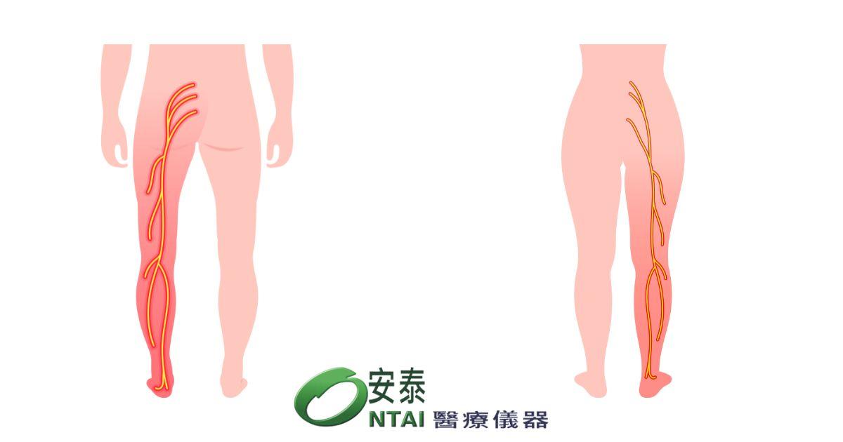 3種方法比較坐骨神經痛如何治療最有效醫師這樣建議 3種方法比較坐骨神經痛如何治療最有效醫師這樣建議